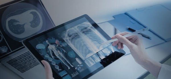 Email marketing campaigns in the pharmaceutical industry